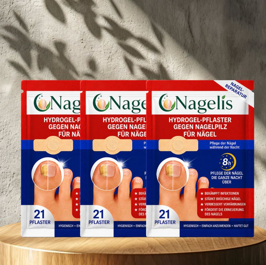 Nagelis