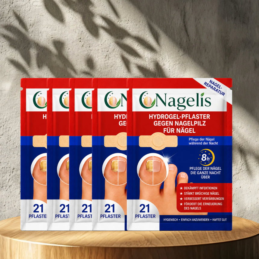 Nagelis